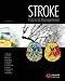 Books : Stroke: Practical Management