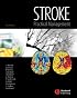 Stroke: Practical Management