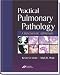 Books : Practical Pulmonary Pathology: A Diagnostic Approach (Pattern Recognition)