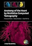 Anatomy of the heart by multislice computed tomography