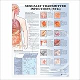 Sexually Transmitted Infections Anatomical Chart