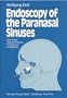 Endoscopy of the Paranasal Sinuses: Technique, Typical Findings, Therapeutic Possibilities