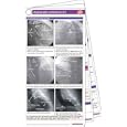 Angiography Pocketcard Set by Anthony Bavry and Mustafa, M.d. Hassan