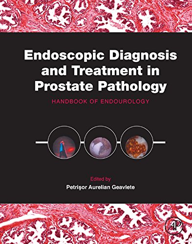 Endoscopic Diagnosis and Treatment in Prostate Pathology: Handbook of Endourology