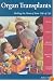 Organ Transplants: Making the Most of Your Gift of Life