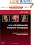 Atlas of Cardiovascular Computed Tomography: Expert Consult - Online and Print: Imaging Companion to Braunwald's Heart Disease, 1e (Imaging Techniques to Braunwald's Heart Disease)