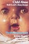 Child Abuse (The Developing Child Series)