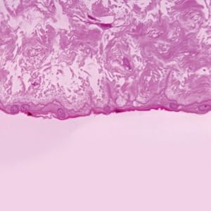 Human Mucous Microscope Slide, c.s.