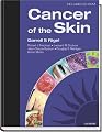 Cancer of the Skin: Text with CD-ROM
