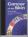 Cancer of the Skin: Text with CD-ROM