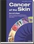Cancer of the Skin: Text with CD-ROM, 1e