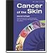Cancer of the Skin: Text with CD-ROM