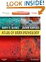 Atlas of Liver Pathology: Expert Consult - Online and Print, 3e (ATLAS OF SURGICAL PATHOLOGY)