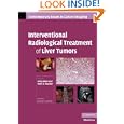 Interventional Radiological Treatment of Liver Tumors (Contemporary Issues in Cancer Imaging)