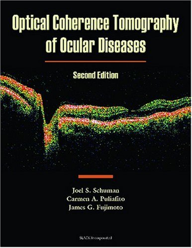 Optical Coherence Tomography of Ocular Diseases, by Joel S. Schuman MD, Carmen A. Puliafito MD, James G. Fujimoto PhD