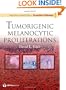 Consultant Pathology: Tumorigenic Melanocytic Proliferations