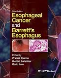 Esophageal Cancer and Barrett's Esophagus