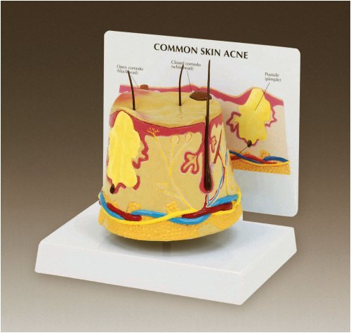 Buy Skin Acne Model With Key Card