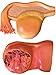 Herindera Ovarian Cysts RS.1500.00
