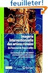 Radiologie interventionnelle des art�...