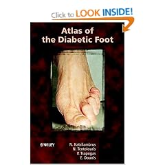 Atlas of the Diabetic Foot