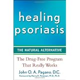 Healing Psoriasis: The Natural Alternative