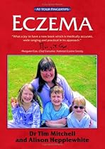 Eczema