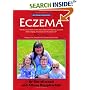 Eczema
