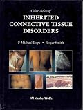 Color Atlas of Inherited Connective Tissue Disorders