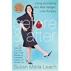 Click here to buy Before and After, Revised Edition: Living and Eating Well After Weight-Loss Surgery by Susan Maria Leach.