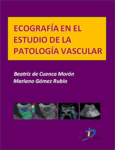Ecografía en el estudio de la patología vascular  (Este capítulo pertenece al libro Tratado de ultrasonografía abdominal) (Spanish Edition)