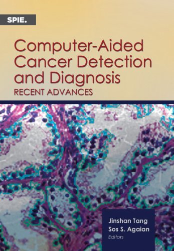 Computer-Aided Cancer Detection and Diagnosis: Recent Advances (SPIE Press Monograph Vol. PM240)