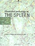 Illustrated Pathology of the Spleen