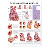 Cardiovascular Disease Anatomical Chart Paper Unmounted