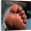 Canvas Prints of Healthy toes and sole of a womans foot from Science Photo Library