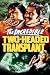 The Incredible Two-Headed Transplant