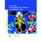 Click here to buy Endoscopic Sinus Surgery by Carlos Yañez.
