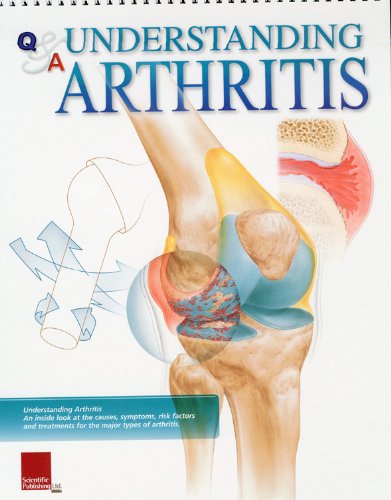 Understanding Arthritis Flip Chart (Flip Charts)