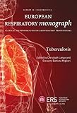 Tuberculosis