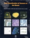 WHO Classification of Tumours of the...