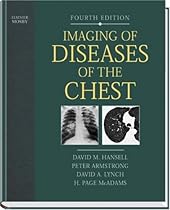 Imaging of Diseases of the Chest, 4e Imaging of Diseases of the Chest, 4e