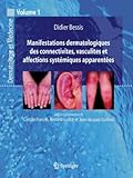 IMAGE OF Manifestations dermatologiques des connectivites, vasculites et affections systémiques apparentées: Dermatologie et médecine, vol. 1 (French Edition)