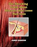 The Shocking Truth About Diseases that Cause Hair Loss: Secrets You Need to Know About Losing Hair So You Can Stop From Going Bald