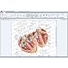 SmartDraw 2009 Healthcare Edition