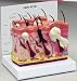 Acne Skin Cross-Section Anatomical Model