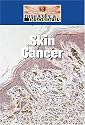 Skin Cancer (Diseases and Disorders)