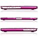 Kuzy - Lace Rubberized Hard Case for Older MacBook Pro 15.4 inch with Retina Display A1398 15 inch Plastic Shell Cover - Lace Raspberry