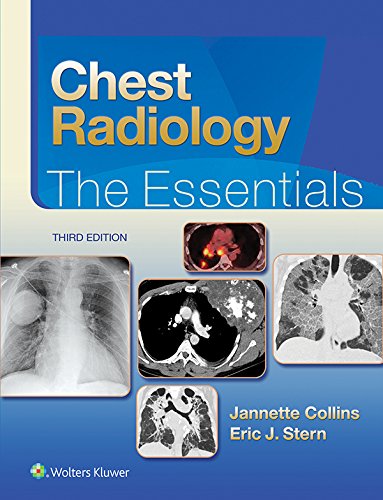Chest Radiology: The Essentials (Essentials series)