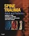 Books : Atlas of Spine Trauma with CD-ROM: Adult & Pediatric