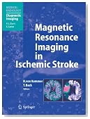 Magnetic Resonance Imaging in Ischemic Stroke (Medical Radiology / Diagnostic Imaging)